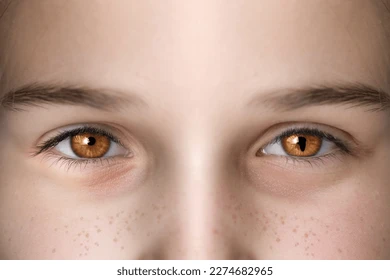 Black Spots in Vision: Causes Symptoms and When to Seek Help